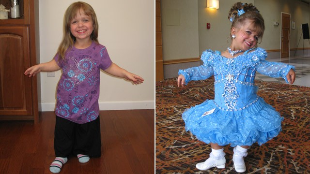 PHOTO: 8-year-old beauty pageant veteran, Lacey-Mae Mason, has achondroplasia, the most common type of dwarfism.