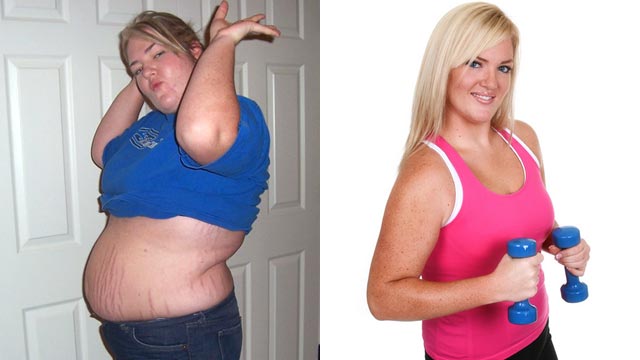 PHOTO: Bride-to-be Linsey Ray turned to bridalplasty before her big day, spending nearly the cost of her wedding to have her body transformed.