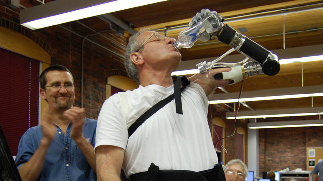 PHOTO: The ?Luke? Arm is a bionic arm currently undergoing FDA trials.
The "Luke" Arm is a bionic arm currently undergoing FDA trials.