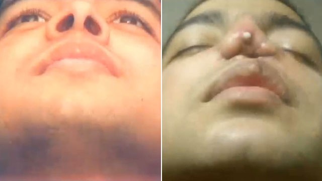 PHOTO: Vishal Thakkar opens up about his plastic surgery nightmare.