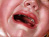 Nucular