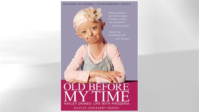 PHOTO: Old Before My Time: Hayley Okines' life with progeria
