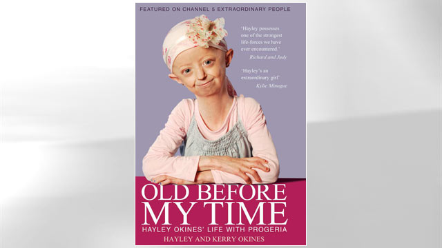 PHOTO: Old Before My Time: Hayley Okines life with progeria