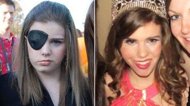 PHOTO: In 2008, Caitlin Cowen suffered partial paralysis after undergoing brain surgery to remove a tumor from the right side of her brain stem.