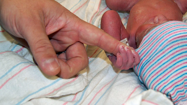 PHOTO: One of the Ferraro quintuplets grabs the finger of their parent shortly after being born, Sept. 26, 2012, at the Banner Desert Medical Center in Mesa, Ariz.