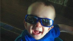 PHOTO: Six-month-old Ryan Burke had surgery to reshape his skull.