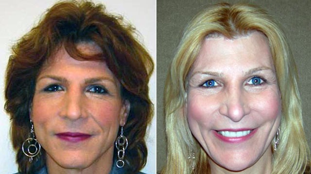 PHOTO: Sarah, 50, said facial feminization surgery made her look younger.