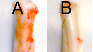 Photo: A new study in mice that shows a potential treatment for spinal injuries by shutting off a gene that allows cells to die off in the hours following the injury, causing paralysis