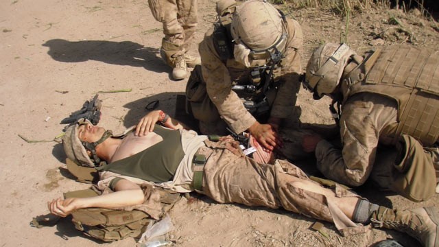 PHOTO: Marine Sgt. Ron Strang lost half of his thigh muscle to shrapnel in Afghanistan.