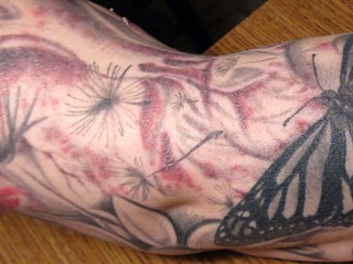 Man's Tattoo Sparks Nationwide Health Alert