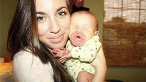 Photo: Baby Born With No Eyes