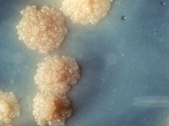 Tuberbulosis