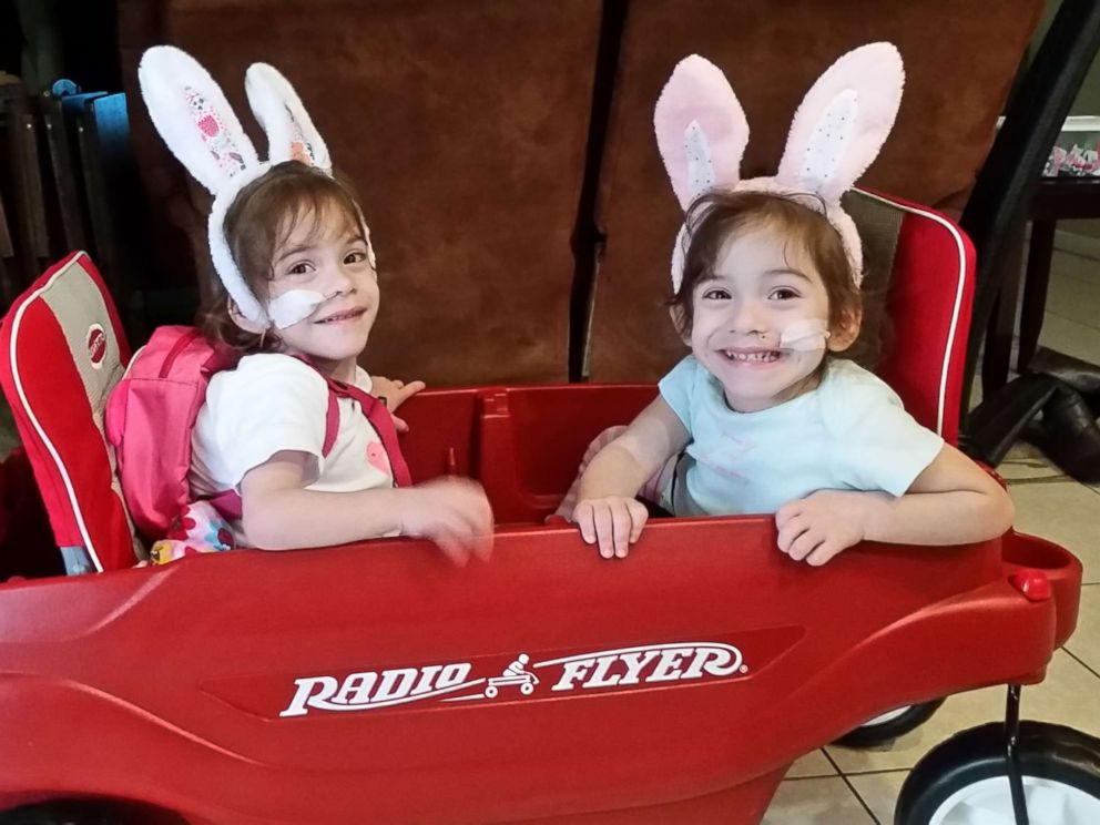 Formerly conjoined twins Eva and Erika Sandoval are seen here after their separation surgery.