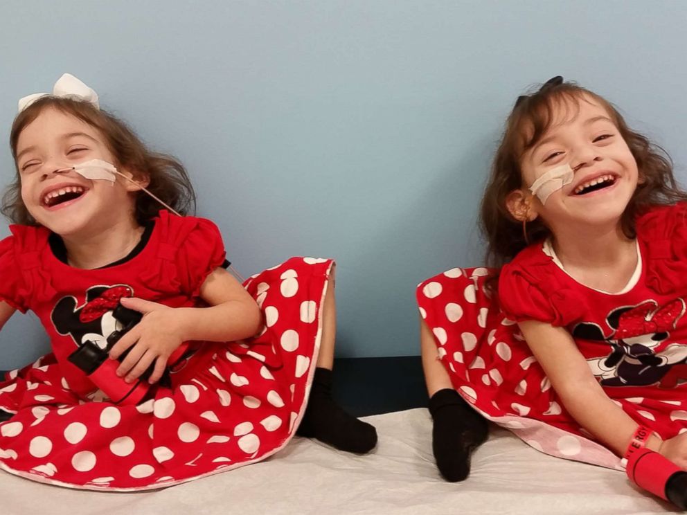 Formerly conjoined twins Eva and Erika Sandoval are seen here after their separation surgery.