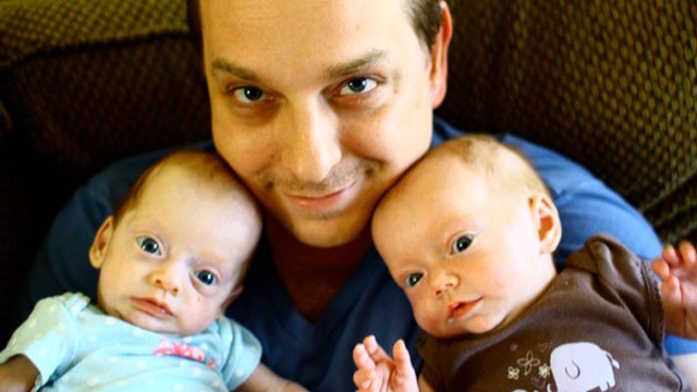 PHOTO: Tyson Wallis died suddenly of a rare heart condition. Soon after his death, his twin daughters were diagnosed with the same condition.