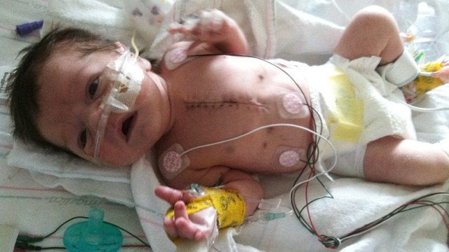 PHOTO: William "Will" Donovan had heart surgery at NYU Langone Medical Center when he was three days old. Three weeks later, Superstorm Sandy forced the hospital to evacuate.