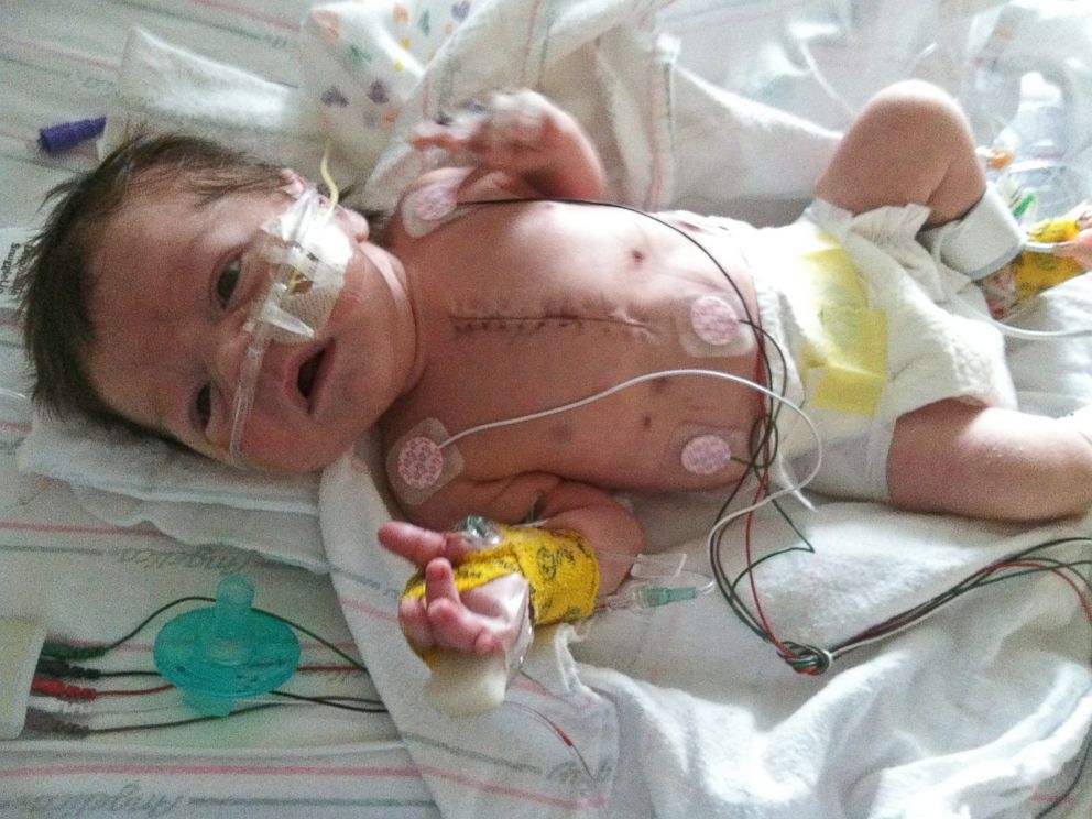 PHOTO: William Will Donovan had heart surgery at NYU Langone Medical Center when he was three days old. Three weeks later, Superstorm Sandy forced the hospital to evacuate.