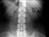 Unusual X-Rays Photos - ABC News