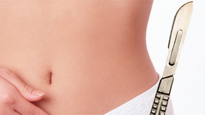 hysterectomy