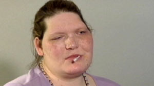 Gigantism May Be Death Sentence for Nevada Woman After Docs Declare Brain Surgery Too Risky