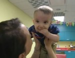 VIDEO: Six-month-old Ryan Burke's skull was growing lopsided until Texas surgeons intervened.
