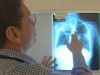 VIDEO: Officials screen anyone who had possible contact with a tuberculosis patient.