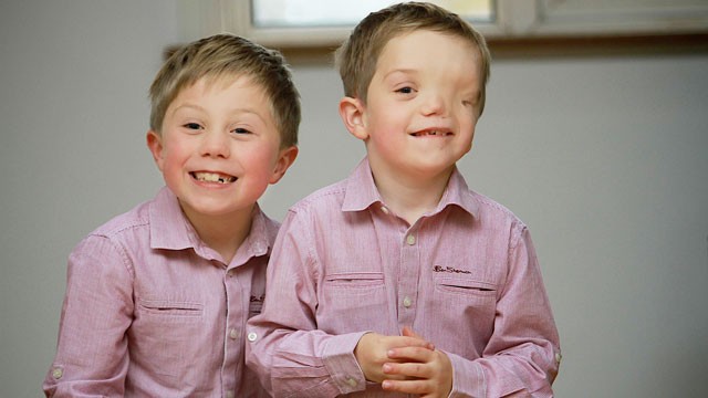 PHOTO: Twins Oliver, left, and Harry Machin pose at home in Stoke-On-Trent, England.
