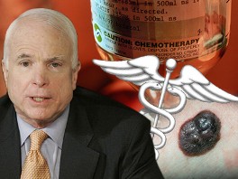 mccain chemo