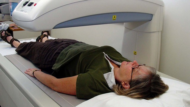 PHOTO: A low-dose x-ray is used for a bone density test.