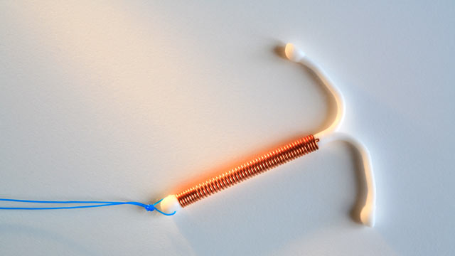 iud birth control