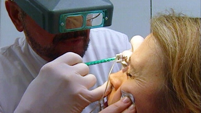 VIDEO: Dysport proved better at reducing wrinkles than its older competition, Botox.