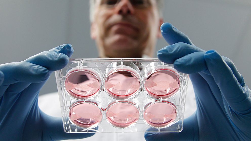 PHOTO: In-vitro meat