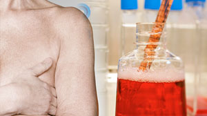 Photo: Using stem cells to regrow breast tissue.