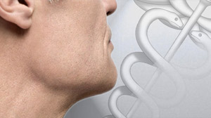 throat disease