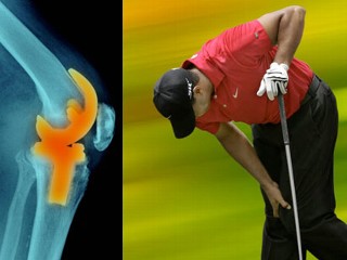 tiger woods knee