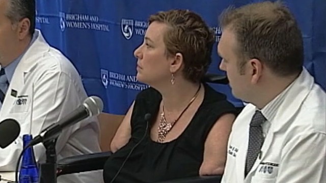 VIDEO: Katy Hayes, 44, had her limbs amputated as a result of a 2010 bacterial infection.