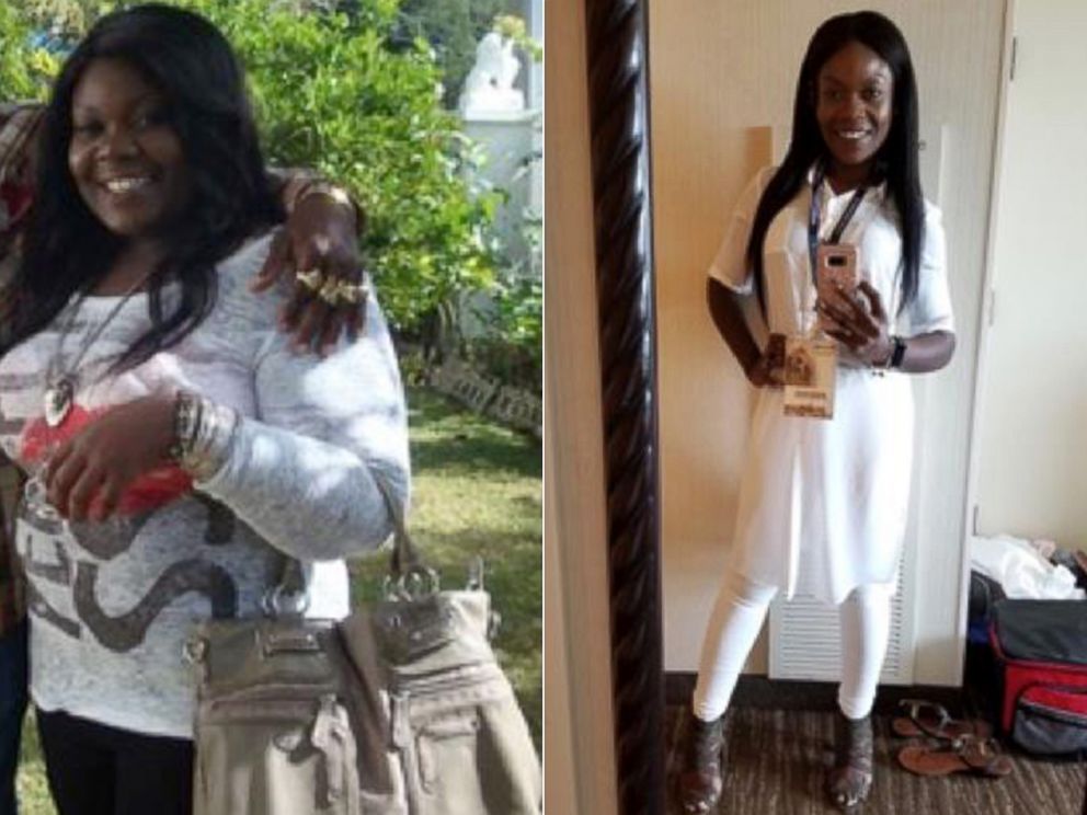 PHOTO: Melody Perdue is pictured before and after her weight loss.