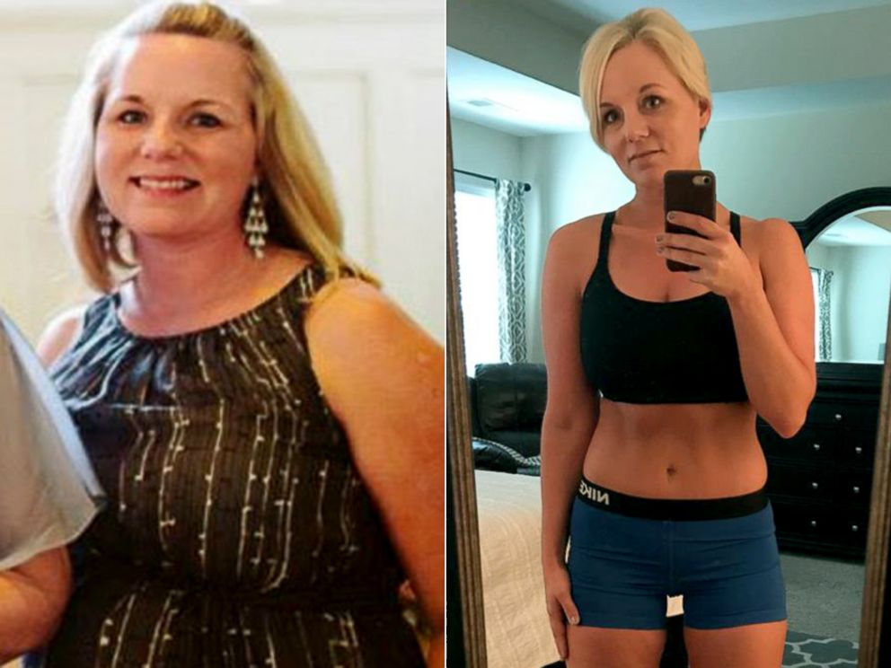 PHOTO: Morgan Root is pictured before and after her weight loss.