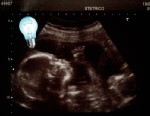 Researchers have found short-term memory in fetuses as early as 30 weeks.