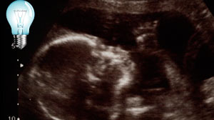 Researchers have found short-term memory in fetuses as early as 30 weeks.