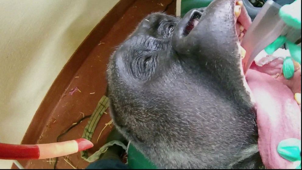 Open Wide See A Gorilla Visit The Dentist Video Abc News 