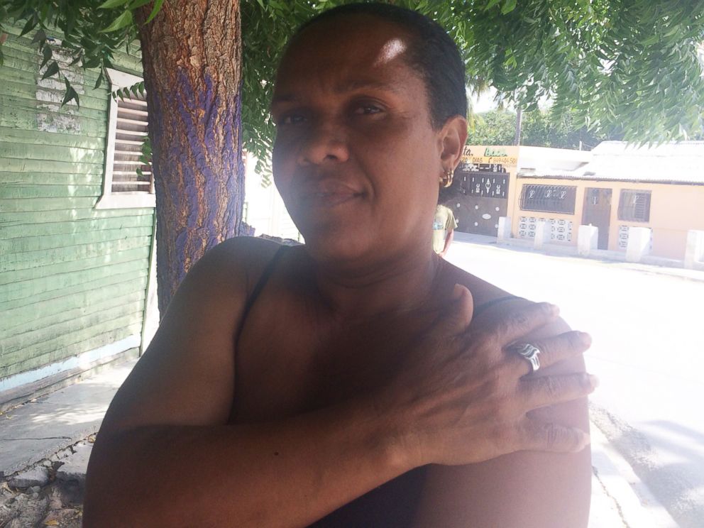 PHOTO: In Salinas, a small town in the Dominican Republic, another woman named Josefa Cuevos said she remembered a childhood friend being one of the guevedoces.
