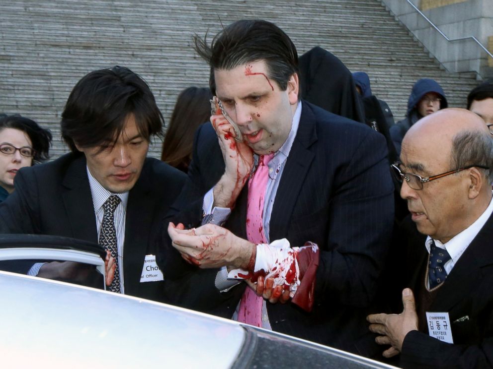 PHOTO: Injured U.S. Ambassador to South Korea Mark Lippert, center, gets into a car to leave for a hospital in Seoul, South Korea, March 5, 2015. 