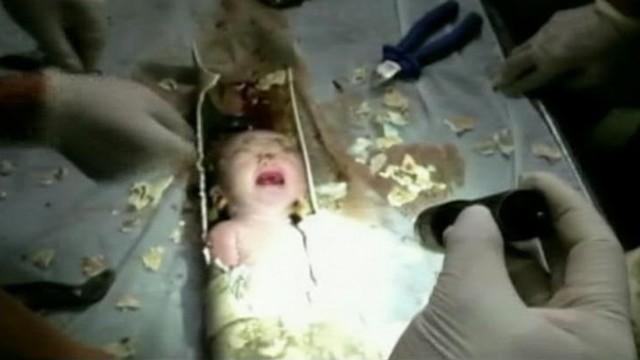 VIDEO: Rescue workers in China saved the infant after sawing through a sewage pipe.