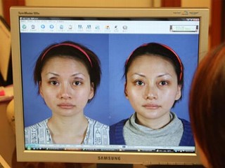 plastic surgery, south korea