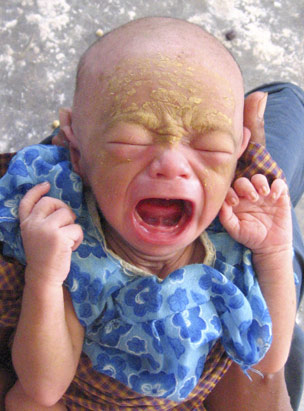 starving baby in yangon