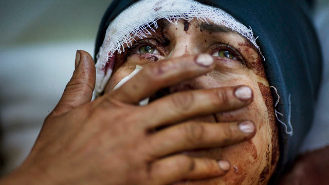 PHOTO: Aida cries as she recovers from severe injuries after the Syrian Army shelled her house in Idlib, north Syria.