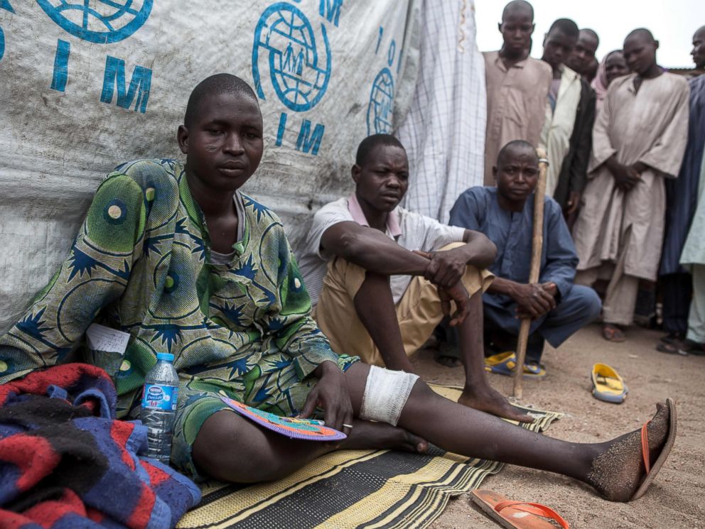 PHOTO: A man, injured by an IED, sits with others outside his tent in the town of Banki in northeastern Nigeria, April 26, 2017.