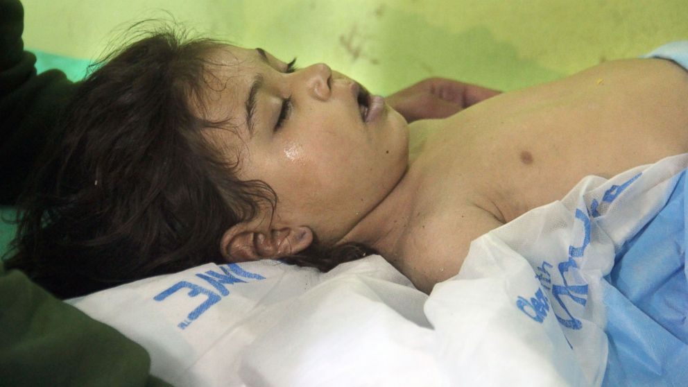 Syrian doctors describe treating children after suspected gas attack
