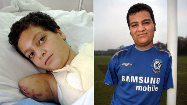 PHOTO: Iraqi Ali Ismail Abbas poses for a picture at Al-Babtain Burns Centre in Kuwiat City in this May 15, 2003 file photo, and right, Abbas, 17, plays football at school in London in December 2008.